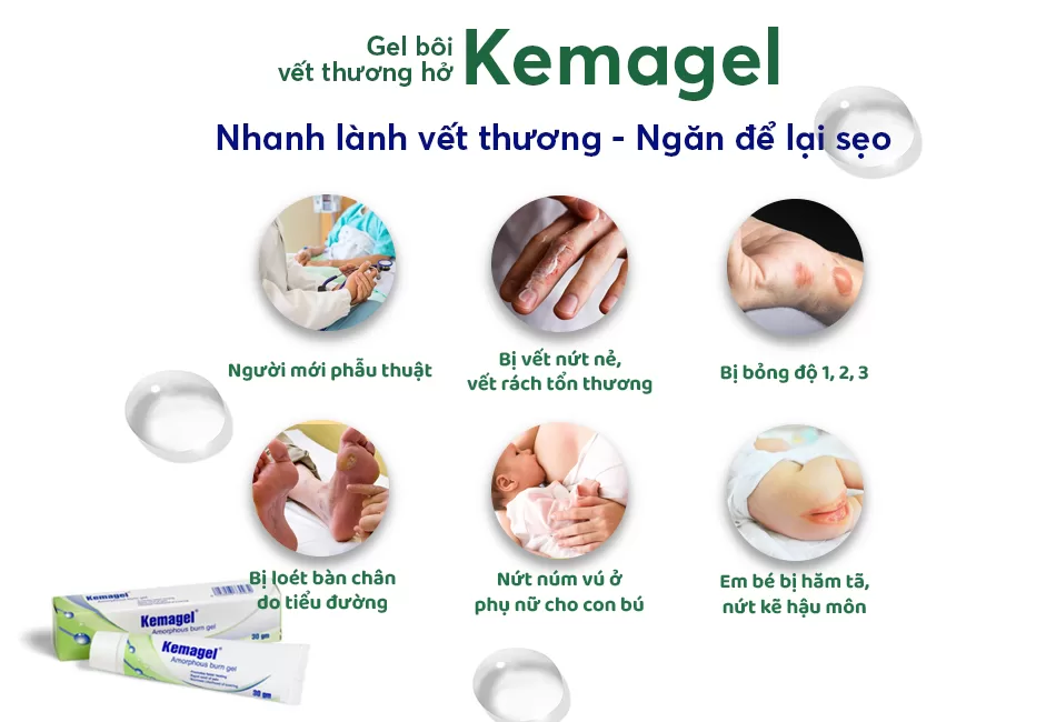 Kemagel dùng bao lâu?